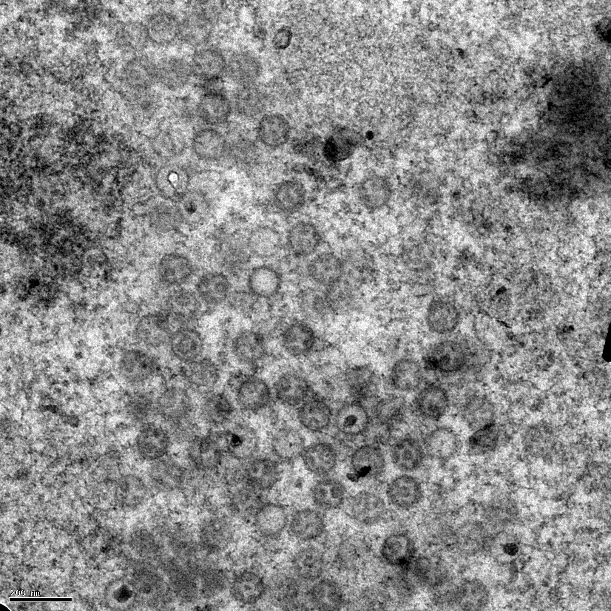 TEM micrograph of immature herpesvirus capsids accumulating in the nucleus of infected cells.